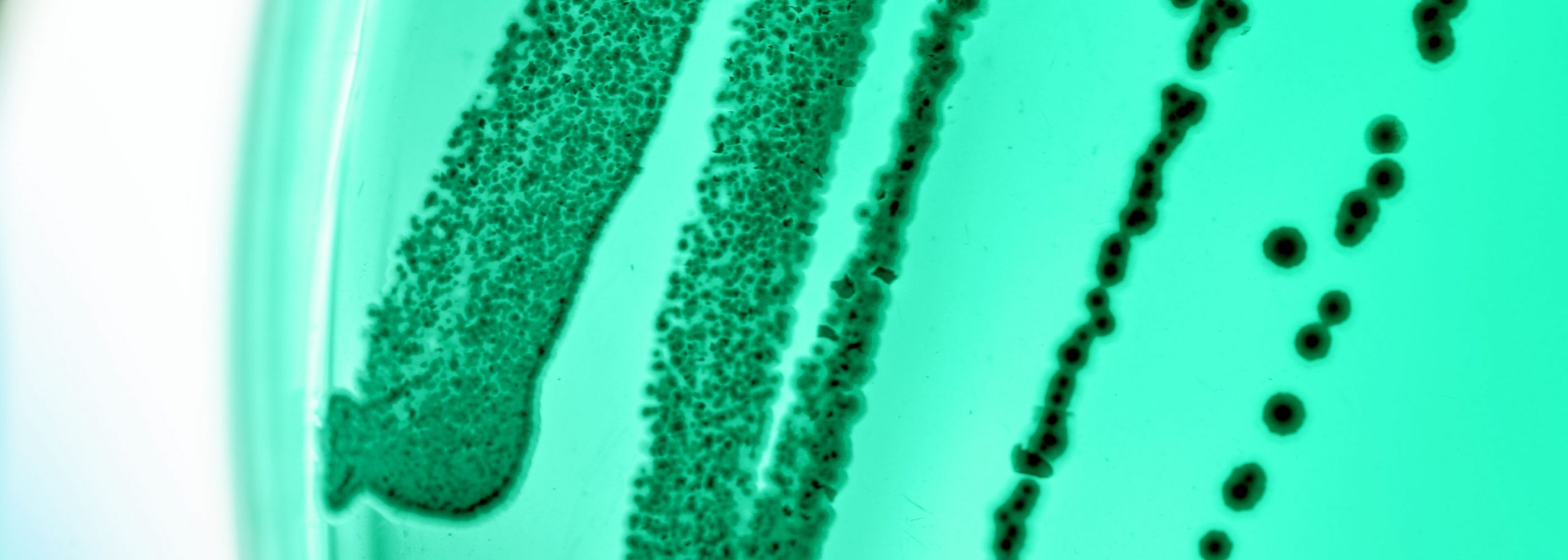 microbial fermentation process development